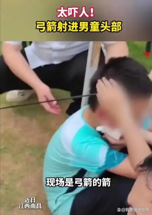 儿子被射穿心态炸裂？齐祖场边直摇头，这个电竞战队到底怎么了